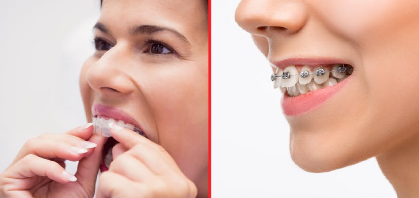 How Much Do Braces Cost?, Orthodontic Services