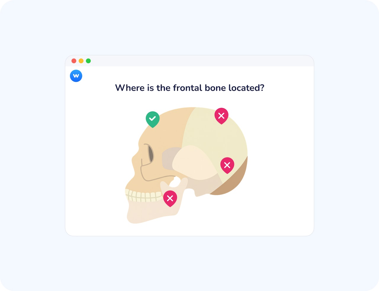 find on an image the frontal bone