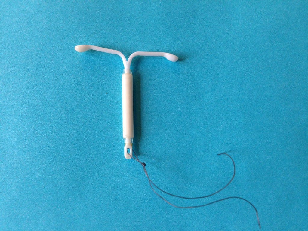 Does Having an IUD Make You a Biohacker or a Cyborg?