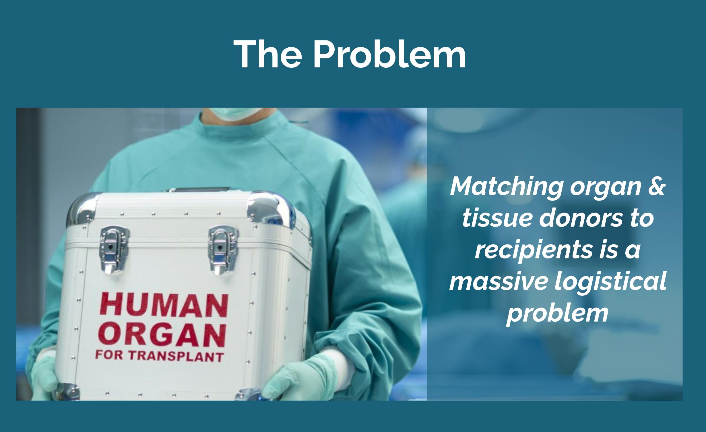 The problem: Matching organ and tissue donors to recipients is a massive logistical problem