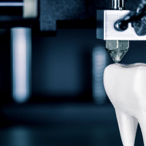 3d printed tooth