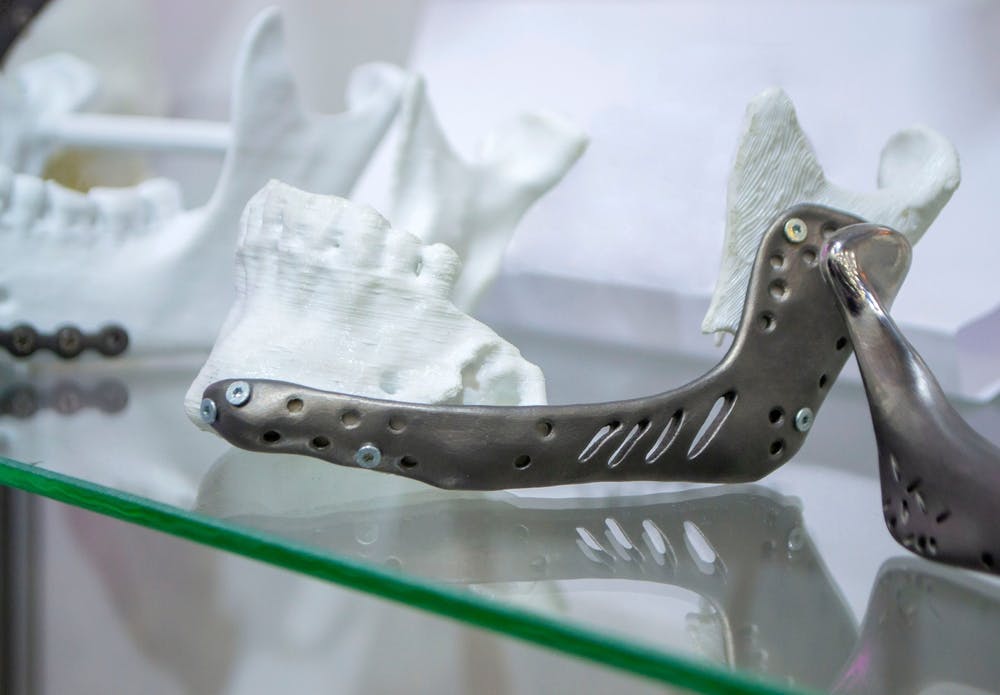 3d printed lower jaw