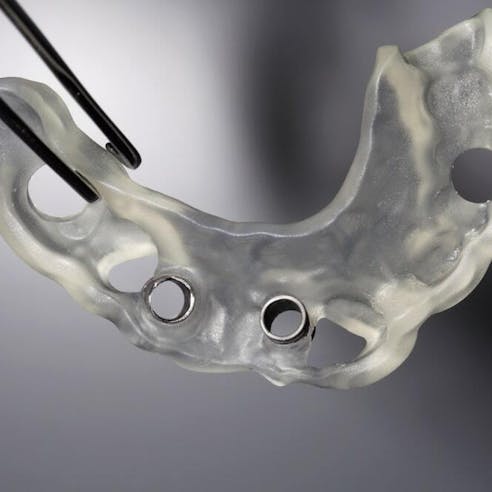 3D printed dental implant. Image Credit: Shutterstock.com/Dental Pro Content