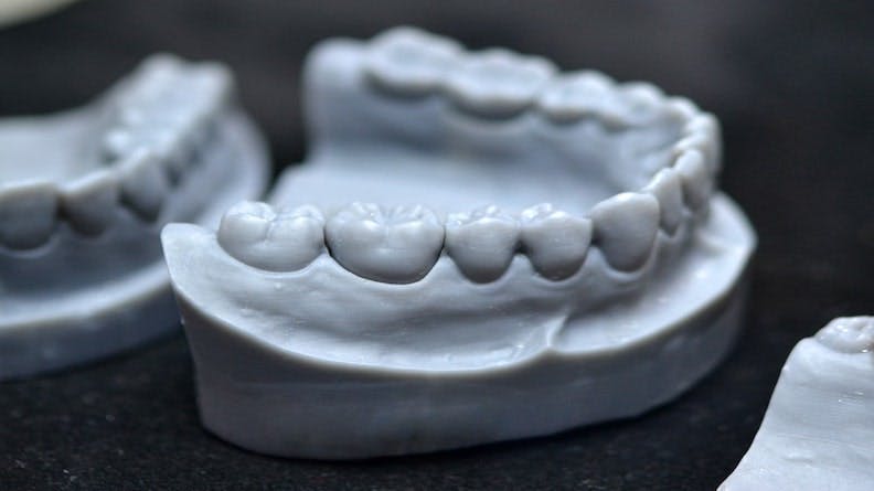 3D Printed Dental Model