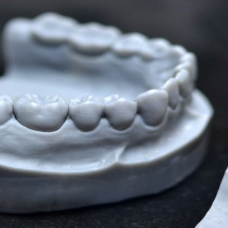Resin 3D printed dental model.