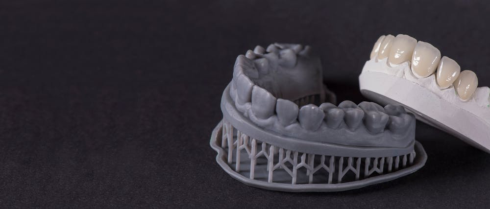 dental implant 3D printed