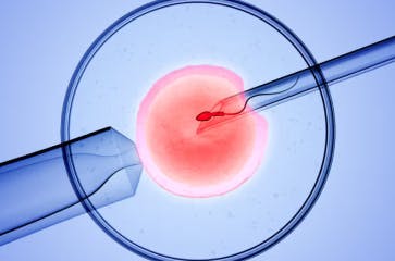 Intracytoplasmic sperm injection (ICSI) is a common procedure used in conjunction with in vitro fertilization (IVF).   By carefully injecting a single healthy sperm into an egg to aid in fertilization, this technique offers hope to couples who are facing male infertility or who have previously struggled with IVF.