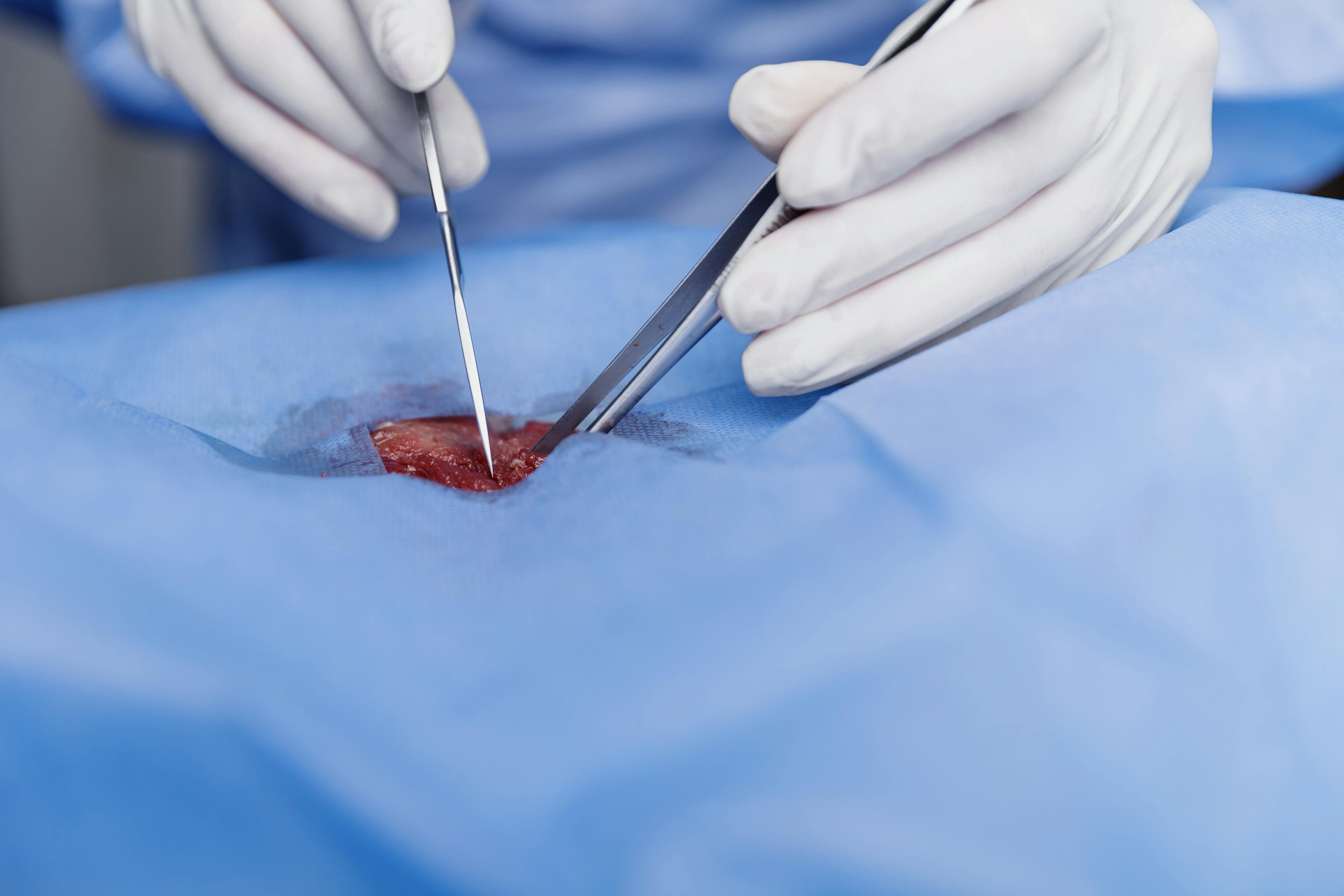 Minimally invasive (small-incision) gynecological surgeries
