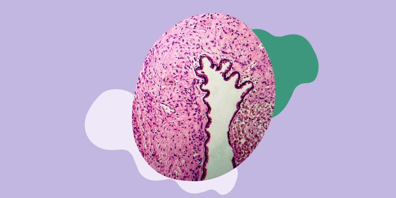 A Simple Guide To Vaginal Cysts