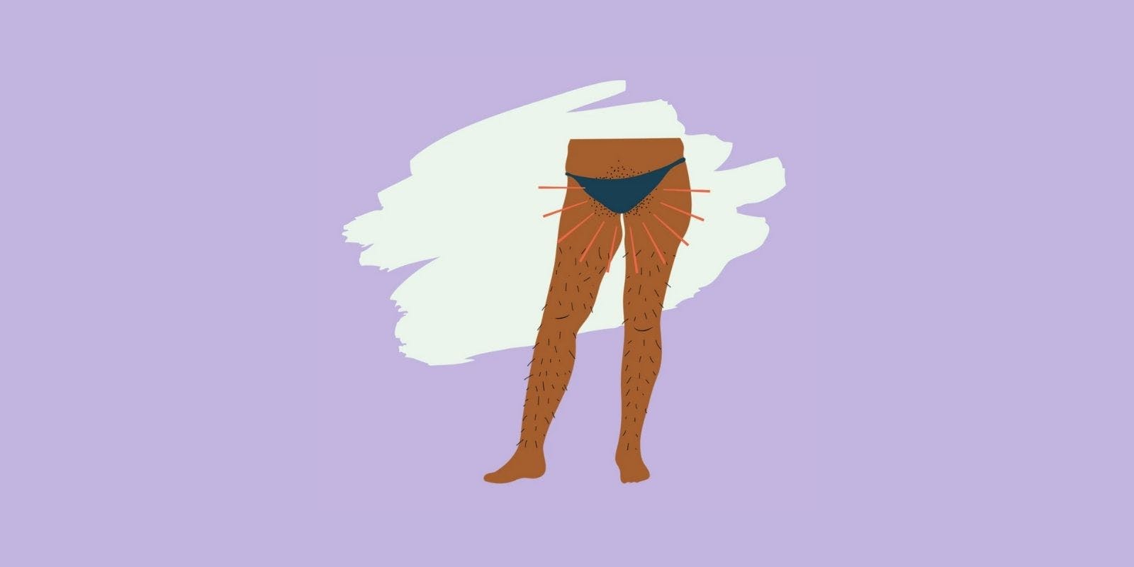 What You Need To Know About Thrush and BV