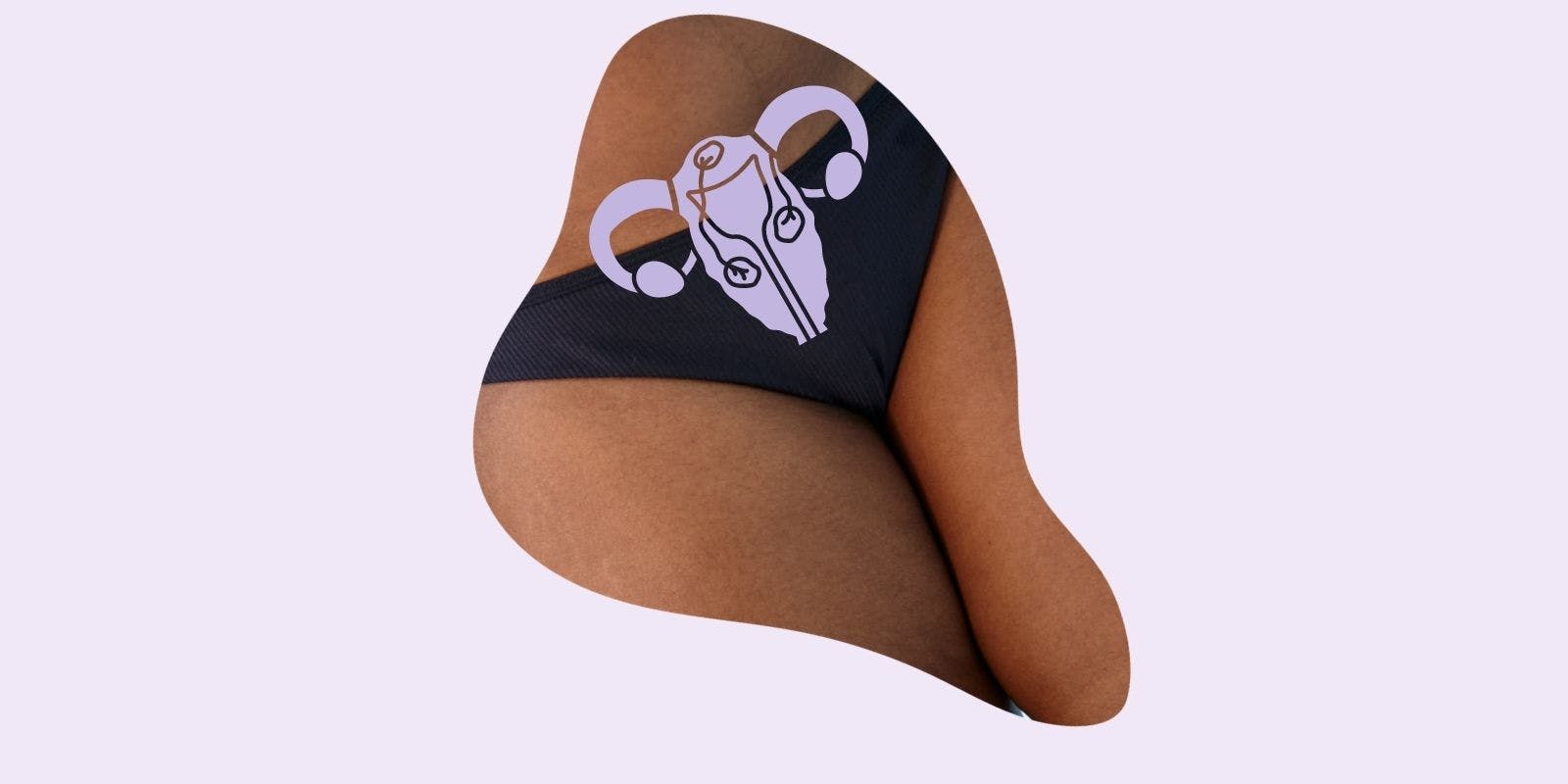 What You Need To Know About Uterine Fibroids