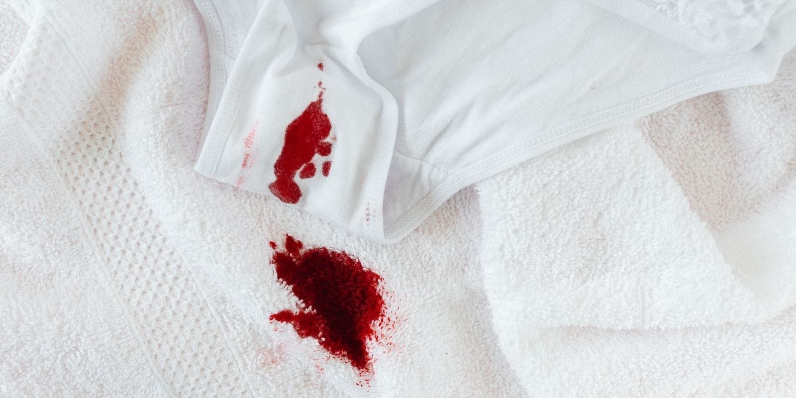 Why We Need To Stop Using Euphemisms For Periods