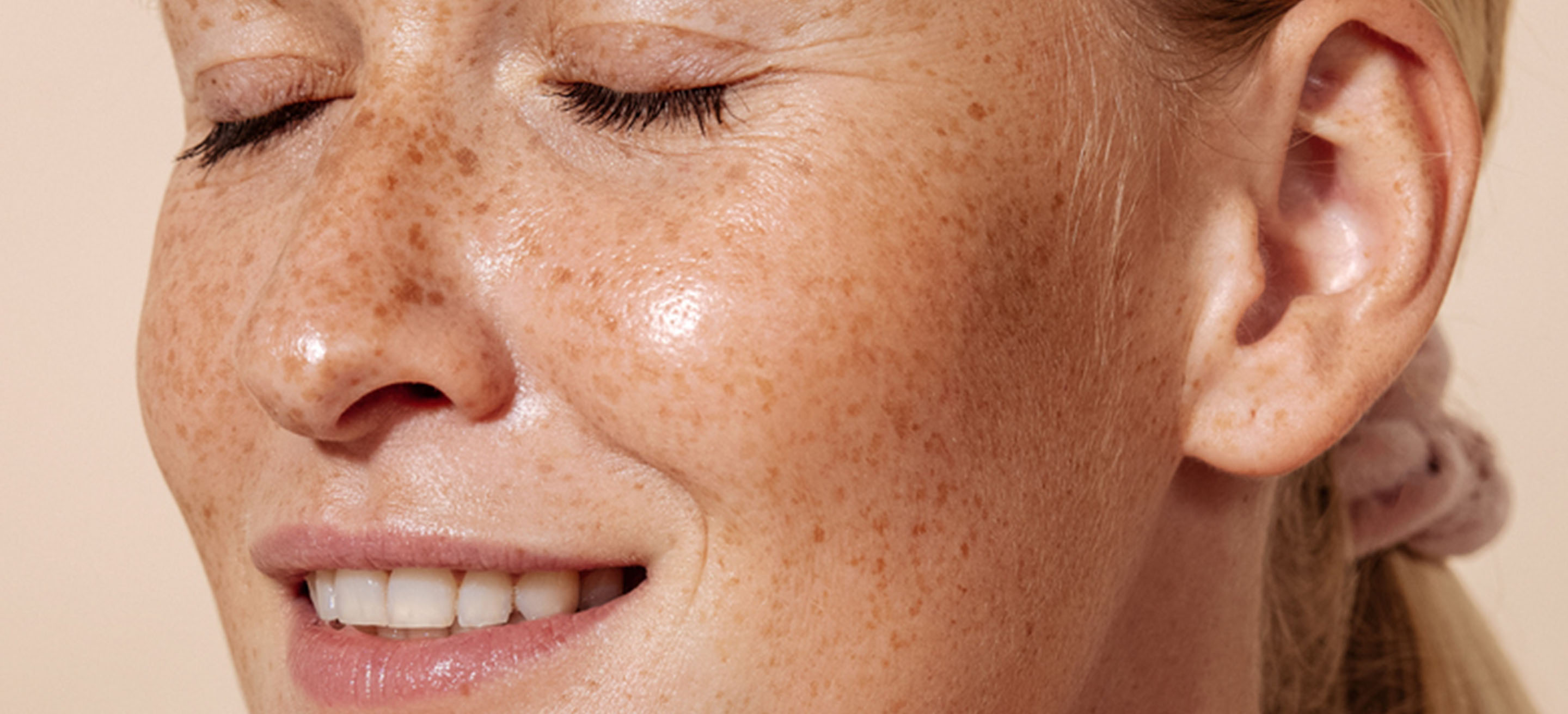 A guide to Microneedling, LED Light Therapy, Laser Genesis and Chemical
