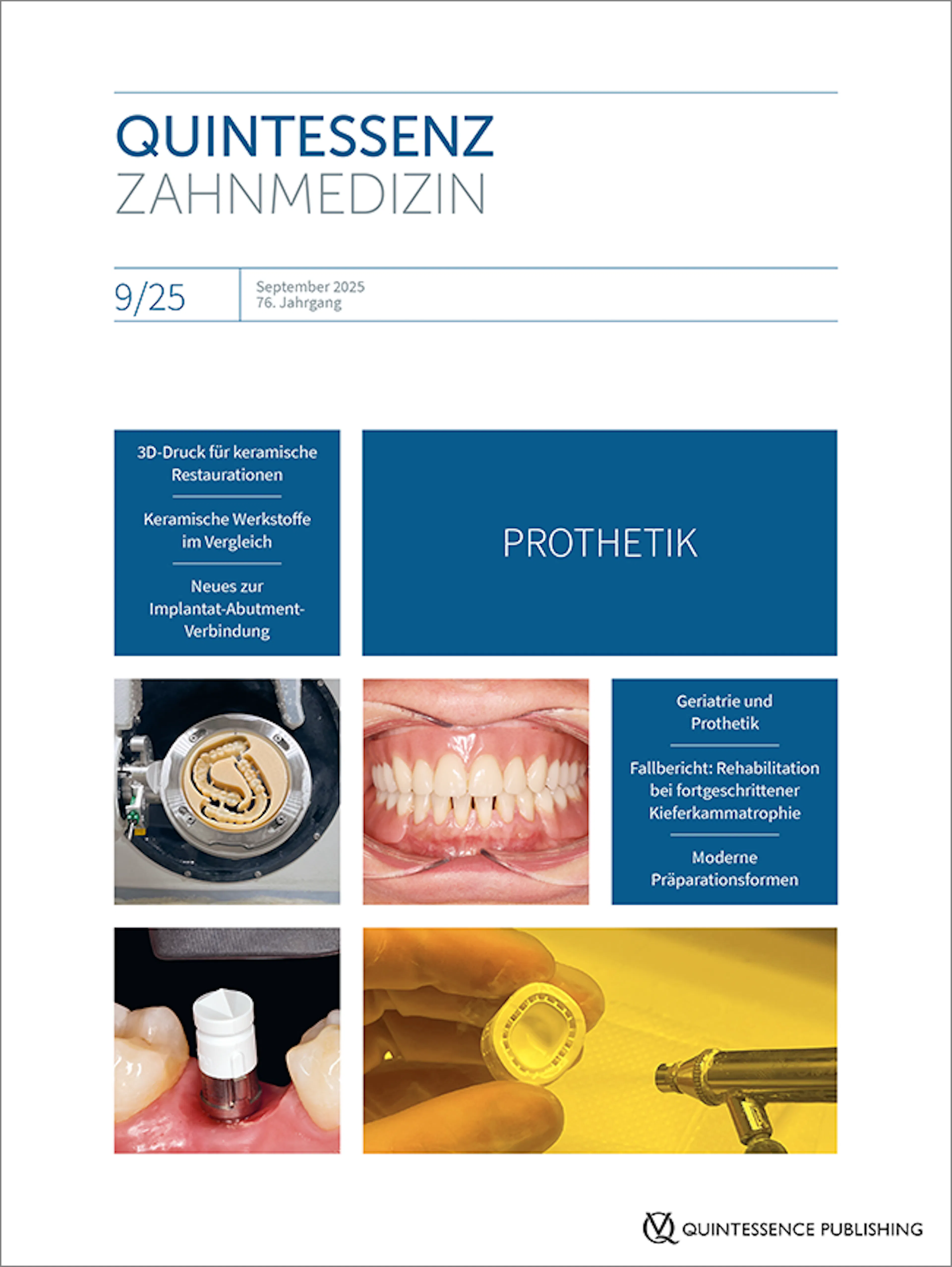 Fachbeitrag zur Extrusion in der Quintessenz Privat-Doz. Dr. Maria Bruhnke, Dr. Felix Zaritzki, Prof. Florian Beuer und Kollegen