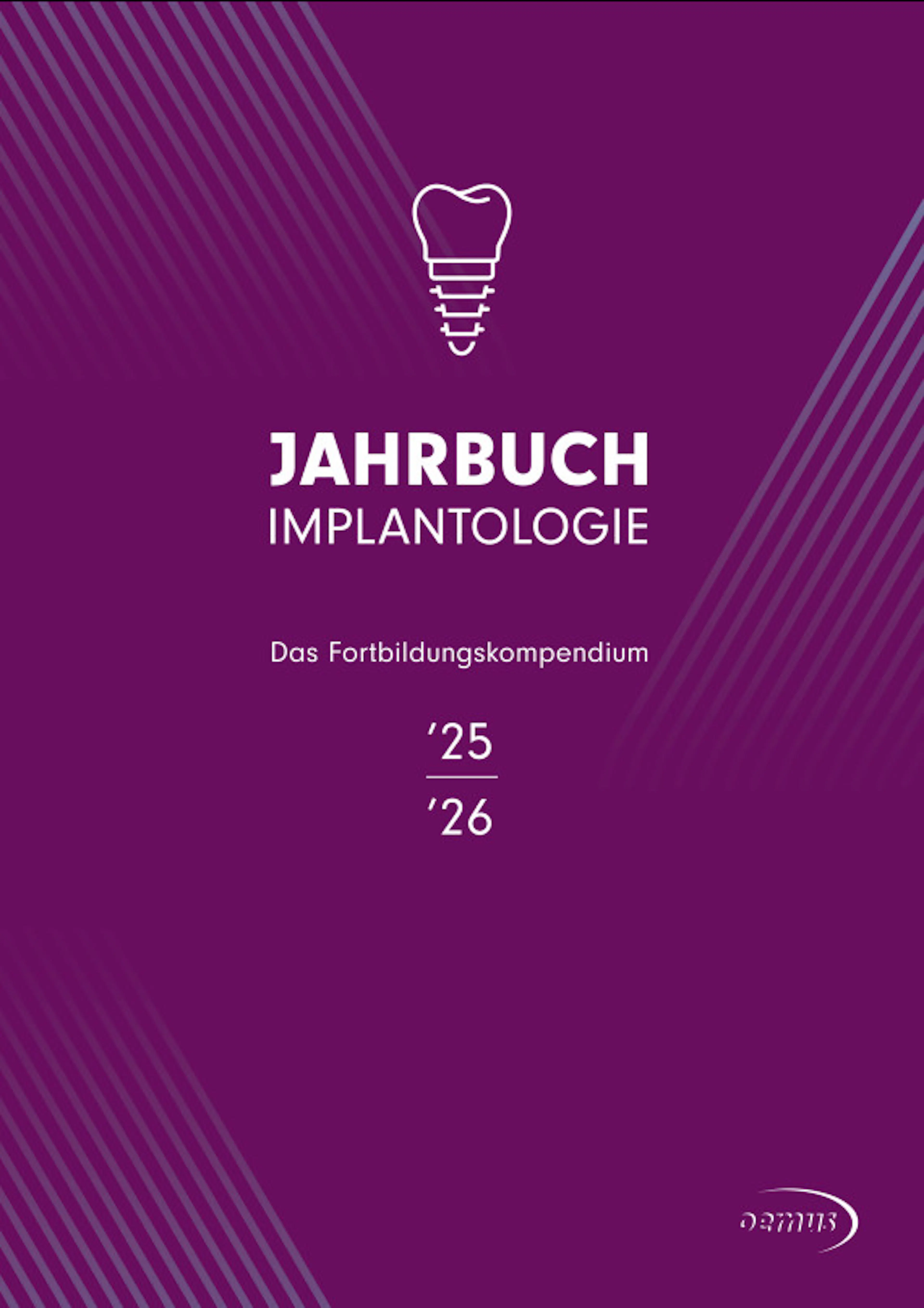 Jahrbuch Implantologie 2025/26 – Beitrag von Dr. Felix Zaritzki