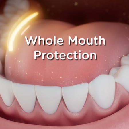 CGI image of mouth - whole mouth protection